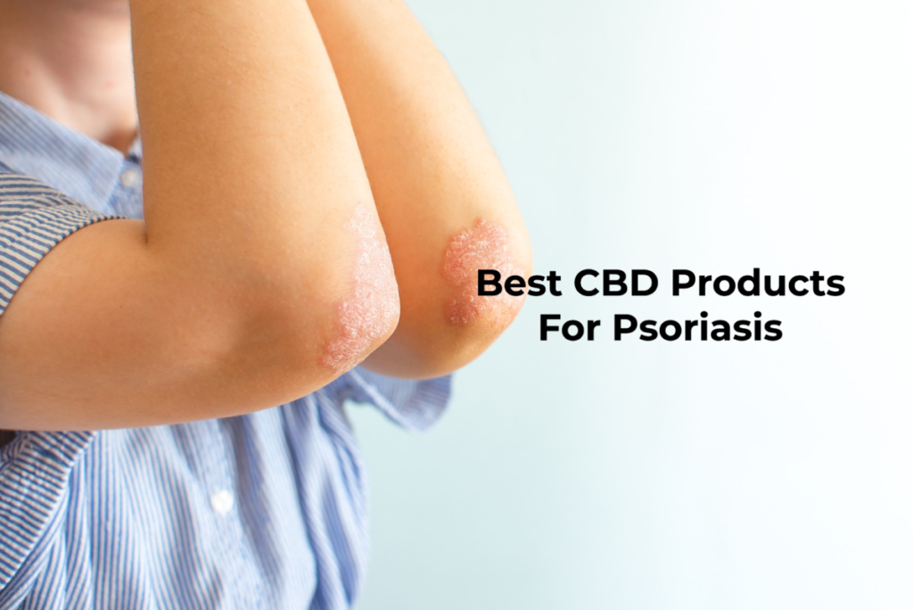 Best CBD Products For Psoriasis
