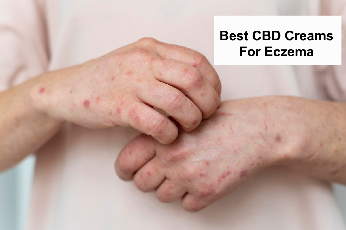 Best CBD Creams For Eczema In 2023